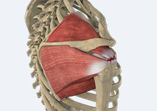 Massive Retracted Rotator Cuff Tear