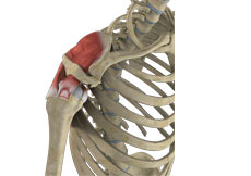 Partial Rotator Cuff Tear