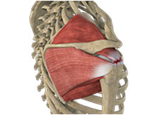 Rotator Cuff Re-tear