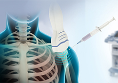 Ultrasound-Guided Shoulder Injections