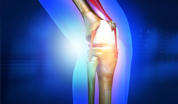 Does a Torn ACL Require Surgery?