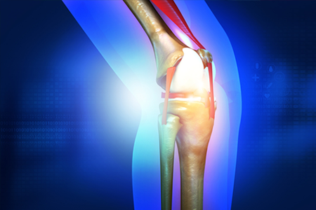 Does a Torn ACL Require Surgery?