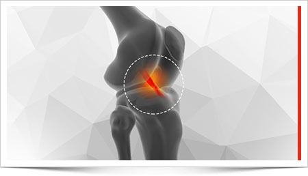 ACL Primary Repair